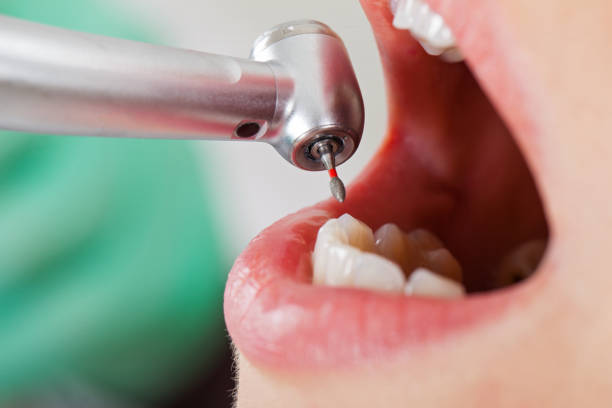 Best Weekend Emergency Dentist in Luxemburg, WI